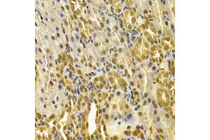 Immunohistochemistry of paraffin-embedded rat kidney using PIN1 antibody at dilution of 1:100 (x400 lens). (PIN1 Antikörper)