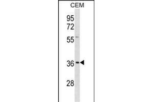 Ephrin B1 Antikörper  (AA 88-116)