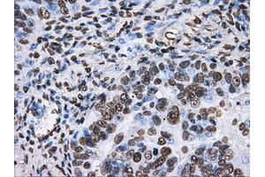 Immunohistochemistry (IHC) image for anti-ATP Synthase, H+ Transporting, Mitochondrial F1 Complex, beta Polypeptide (ATP5B) antibody (ABIN1496766)