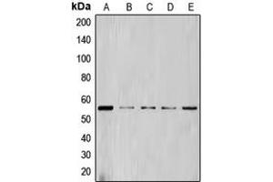 Western blot analysis of Cyclin L1 expression in HL60 (A), NIH3T3 (B), Jurkat (C), THP1 (D), K562 (E) whole cell lysates.
