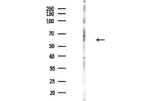 Western blot analysis of lysates from Hela cells(heat-shock,45 min treatment), using SEMG Antibody at 1/1000 dilution.