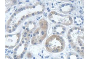 DAB staining on IHC-P; Samples: Human Kidney Tissue (IARS Antikörper  (AA 1-500))