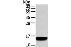Western Blot analysis of Human normal prostate tissue using VAMP5 Polyclonal Antibody at dilution of 1/650 (VAMP5 Antikörper)