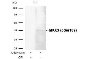 Western blot analysis of extracts from 3T3 cells, treated with Anisomycin or calf intestinal phosphatase (CIP), using MKK3 (Phospho-Ser189) Antibody. (MAP2K3 Antikörper  (pSer189))