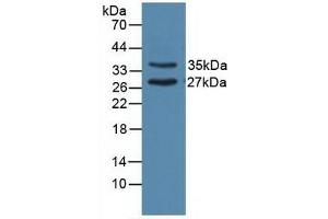 Detection of UNG in Porcine Heart Tissue using Polyclonal Antibody to Uracil DNA Glycosylase (UNG) (UNG Antikörper  (AA 1-313))