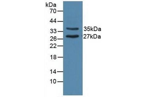 UNG Antikörper  (AA 1-313)