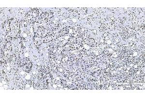 IHC analysis of FOXK1 using anti-FOXK1 antibody (ABIN7600295). (Foxk1 Antikörper  (AA 175-671))