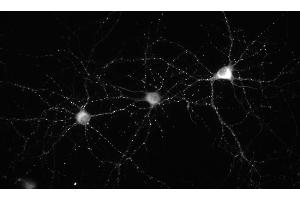 Immunofluorescence staining of 14 DIV cultured rat hippocampal neurons. (DLG2 Antikörper  (AA 1-852))