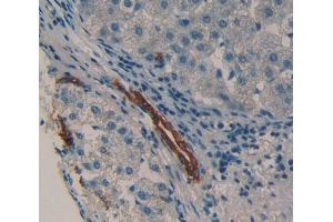 Used in DAB staining on fromalin fixed paraffin- embedded Kidney tissue (HCK Antikörper  (AA 2-526))