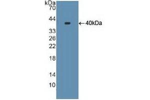 Detection of Recombinant S17aH, Human using Polyclonal Antibody to Cytochrome P450 17A1 (CYP17A1) (CYP17A1 Antikörper  (AA 183-508))