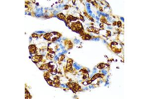 Immunohistochemistry of paraffin-embedded human placenta using HBG1 Rabbit mAb (ABIN1679149, ABIN1679148, ABIN7101336 and ABIN7101337) at dilution of 1:100 (40x lens). (HBG1/2 Antikörper)