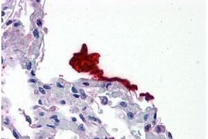 Human Lung: Formalin-Fixed, Paraffin-Embedded (FFPE) (Kallikrein 6 Antikörper  (AA 74-123))