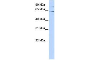 WB Suggested Anti-XPNPEP2 Antibody Titration:  0. (XPNPEP2 Antikörper  (Middle Region))