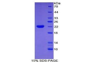 SDS-PAGE analysis of Human Cofilin 2, Muscle Protein.