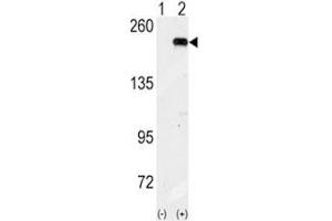 Western Blotting (WB) image for anti-Eukaryotic Translation Initiation Factor 2 alpha Kinase 4 (EIF2AK4) (AA 1-30) antibody (ABIN3028641)