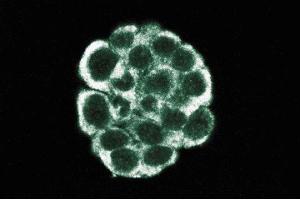 Immunofluorescent staining of WIDR cells. (Dynamitin Antikörper  (AA 55-196))