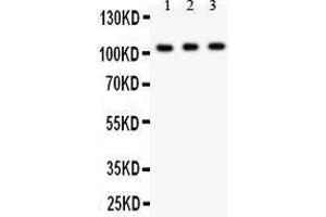 Anti- GRIK1 antibody, Western blotting All lanes: Anti GRIK1  at 0. (GRIK1 Antikörper  (AA 271-450))
