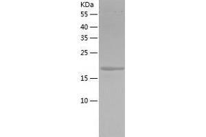 Western Blotting (WB) image for Myosin Regulatory Light Chain 2, Smooth Muscle Isoform (MYL9) (AA 1-172) protein (His tag) (ABIN7124069)
