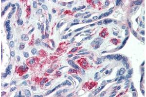 Human Placenta (formalin-fixed, paraffin-embedded) stained with STX12 antibody ABIN364383 at 20 ug/ml followed by biotinylated anti-mouse IgG secondary antibody ABIN481714, alkaline phosphatase-streptavidin and chromogen. (Syntaxin 12 Antikörper  (Cytoplasmic Domain))