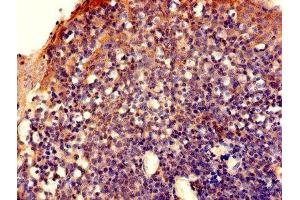 Immunohistochemistry of paraffin-embedded human tonsil tissue using ABIN7152377 at dilution of 1:100 (CAPZA2 Antikörper  (AA 2-286))