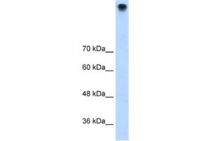 Western Blotting (WB) image for anti-Transient Receptor Potential Cation Channel, Subfamily M, Member 3 (TRPM3) antibody (ABIN2461176)