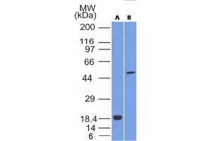 Western Blot Analysis of SOX10 (A) Recombinant protein; (B) A375 cell lysate using SOX10 Mouse Monoclonal Antibody (SOX10/1074).