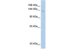 WB Suggested Anti-MOV10 Antibody Titration:  1. (MOV10 Antikörper  (C-Term))