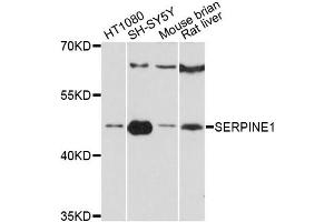 Western blot analysis of extracts of various cell lines, using SERPINE1 antibody (ABIN5998780) at 1:3000 dilution. (PAI1 Antikörper)