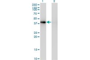Western Blot analysis of PCYT1A expression in transfected 293T cell line by PCYT1A monoclonal antibody (M03), clone 7H8. (PCYT1A Antikörper  (AA 2-90))
