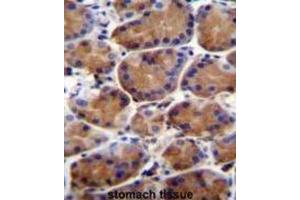 Immunohistochemistry (IHC) image for anti-Leucine-Rich Repeat and WD Repeat-Containing Protein 1 (LRWD1) antibody (ABIN2996388)
