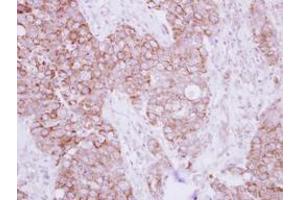 Image no. 1 for anti-Transforming Growth Factor beta Regulator 4 (TBRG4) (AA 1-328) antibody (ABIN1501337)