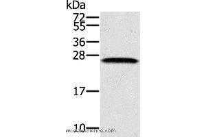 Western blot analysis of K562 cell, using SSX1 Polyclonal Antibody at dilution of 1:400