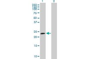 Western Blot analysis of TPD52L1 expression in transfected 293T cell line by TPD52L1 MaxPab polyclonal antibody. (TPD52L1 Antikörper  (AA 1-204))