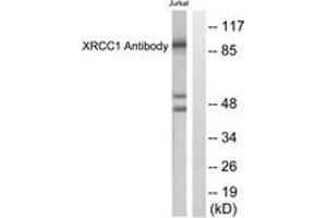 Western blot analysis of extracts from Jurkat cells, using XRCC1 Antibody. (RCC1 Antikörper  (AA 517-566))