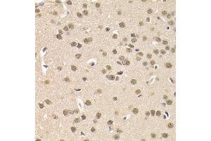 Immunohistochemistry of paraffin-embedded mouse brain using CSNK1E Antibody. (CK1 epsilon Antikörper)