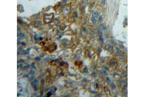 IHC-P analysis of Lung tissue, with DAB staining. (ECE1 Antikörper  (AA 214-448))