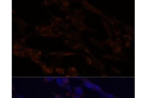 Immunofluorescence analysis of NIH/3T3 cells using IKK alpha Polyclonal Antibody at dilution of 1:100. (IKK alpha Antikörper)