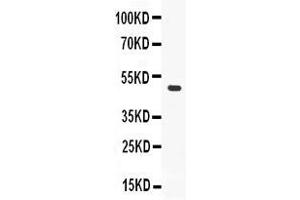 Western blot analysis of ADFP expression in MCF-7 whole cell lysates ( Lane 1). (ADRP Antikörper  (AA 226-418))