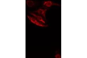 ABIN6276512 staining  HeLa cells by IF/ICC. (SMAD1 Antikörper  (Internal Region))
