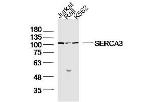 Lane1: jurkat Lane 2: raji Lane 3: K562 lysates probed with SERCA3 Polyclonal Antibody, Unconjugated  at 1:300 dilution and 4˚C overnight incubation. (ATP2A3 Antikörper  (AA 101-200))