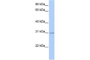 WB Suggested Anti-HOXC11 Antibody Titration:  0. (HOXC11 Antikörper  (Middle Region))