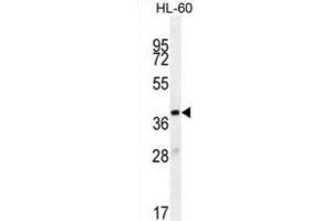 Western Blotting (WB) image for anti-Olfactory Receptor, Family 10, Subfamily J, Member 5 (OR10J5) antibody (ABIN2996119) (OR10J5 Antikörper)