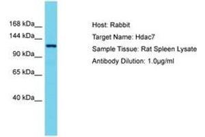 Image no. 1 for anti-Histone Deacetylase 7 (HDAC7) (AA 57-106) antibody (ABIN6750273) (HDAC7 Antikörper  (AA 57-106))