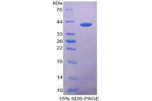 SDS-PAGE (SDS) image for Keratin 14 (KRT14) (AA 122-429) protein (His tag) (ABIN2125549)
