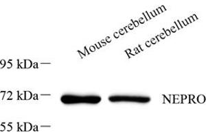 NEPRO Antikörper