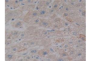 Detection of NOS2 in Human Liver Tissue using Polyclonal Antibody to Nitric Oxide Synthase 2, Inducible (NOS2)