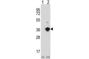 Western blot analysis of ANGPTL7 antibody and 293 cell lysate either nontransfected (Lane 1) or transiently transfected (2) with the ANGPTL7 gene. (ANGPTL7 Antikörper  (AA 74-104))