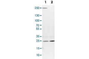 Western Blot analysis of Lane 1: NIH-3T3 cell lysate (mouse embryonic fibroblast cells) and Lane 2: NBT-II cell lysate (Wistar rat bladder tumour cells) with VPS28 polyclonal antibody . (VPS28 Antikörper)