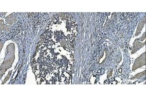 IHC analysis of MCU using anti-MCU antibody (ABIN7601931).