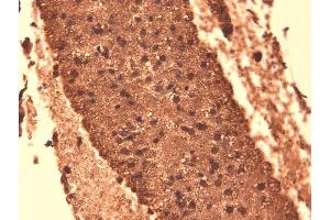 Immunohistochemistry analysis using Mouse Anti-Sodium Iodide Symporter Monoclonal Antibody, Clone 14F . (SLC5A5 Antikörper  (AA 468-643) (Atto 488))